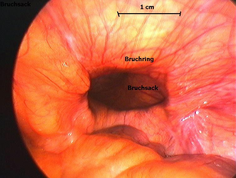 dirbruch.jpg (77973 Byte)